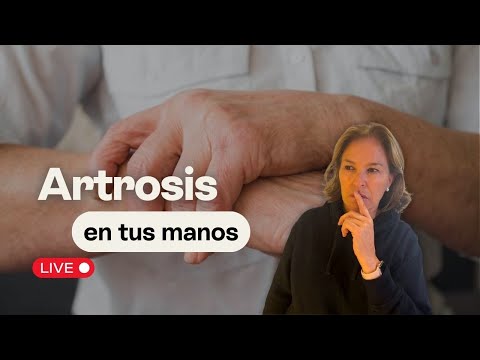 Artrosis en tus manos
