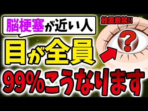 【40代50代】見逃すな！脳梗塞に繋がる目の異常！？わかりやすい5つのサインとは？【うわさのゆっくり解説】脳梗塞/目/サイン