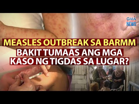 Bakit Tumaas Ang Mga Kaso Ng Measles Sa Barmm Need To Know Videos