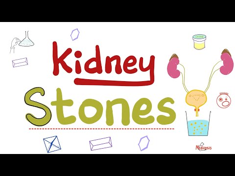 Kidney Stones & Urine crystals (Crystalluria)