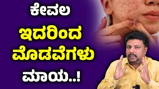 ಯಾವುದೇ ಕ್ರೀಮ್ ಸೋಪ್ ಬೇಡ ಇದರಿಂದ ಪಿಂಪಲ್ಸ್ ಗೆ ಪರಿಹಾರ | Pimple Acne Removal | Modave Tips In Kannada