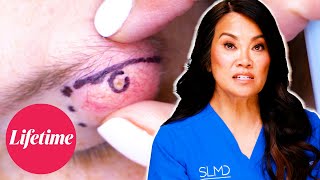 Dr. Lee Removes a HUGE Cyst Near a Patient’s Eye! | Dr. Pimple Popper: Breaking Out (S1) | Lifetime