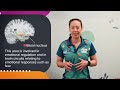 Anxiety and the Amygdala in Autism