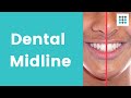 Dental Midlines and Bite Issues