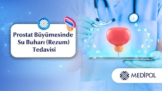 İyi Huylu Prostat Büyümesi Tedavisinde Yenilik: Su Buharı (Rezum) ile Konforlu Çözüm