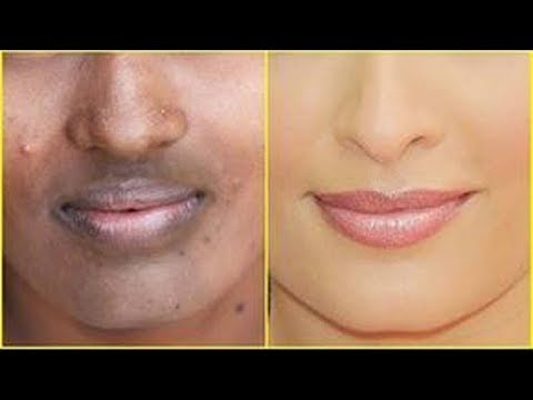 रात को सिर्फ 2 बूँद लगालो चेहरे से दाग धब्बे कालापन पिम्पल्स मिनटो में दूर हो कर चेहरा गोरा हो जाएगा