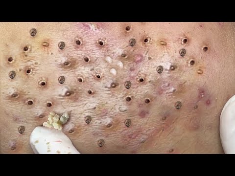 Most Satisfying and Relaxation with An Spa Video #2118