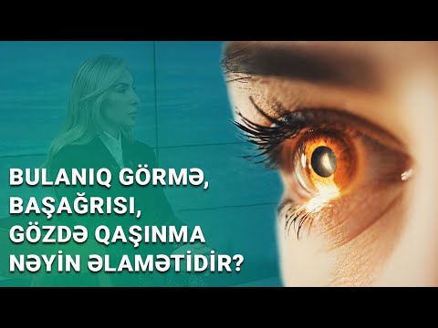 Gözdə qızartı varsa, diqqətli olun! | Astiqmatizm necə yaranır? - BAKU MED