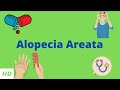 Alopecia Areata: Causes and Treatments