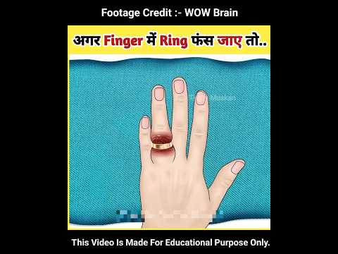 अगर Finger में Ring फंस जाए तो.. #asmr #shortsvideo