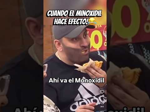 Cuando el minoxidil hace efecto la barba de macho alfa!😂#shorts #mexico #fyp #memes #humor #banda