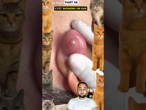Wow! #pimple #pimplepopper #pimples #shortsfeed #shortvideo #shorts #youtubeshorts #youtube | Part94
