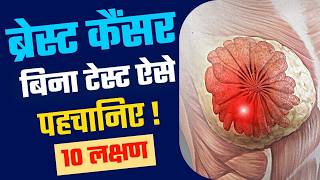 10 Early Signs of Breast Cancer | Breast Cancer Symptoms । ब्रेस्ट कैंसर के शुरूआती लक्षण