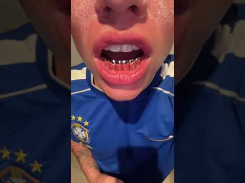 sinetmatteo🤪: #shorts #short #sinetmatteo