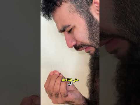 لماذا ينمو الشعر بكثرة لدى بعض الناس 😮