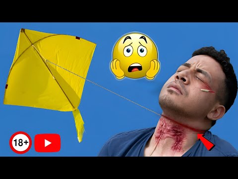 पतंग के मांजे से होने वाली दर्दनाक घटनाएं😨 | Kite Flying