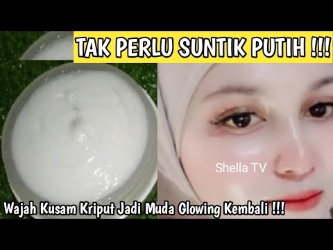 Belum Banyak Yang Tahu !! Cuma Oles Gosok Di Wajah Cukup 10 Menit Flek Krutan Mmudar #shellamarsela