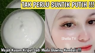 Belum Banyak Yang Tahu !! Cuma Oles Gosok Di Wajah Cukup 10 Menit Flek Krutan Mmudar #shellamarsela