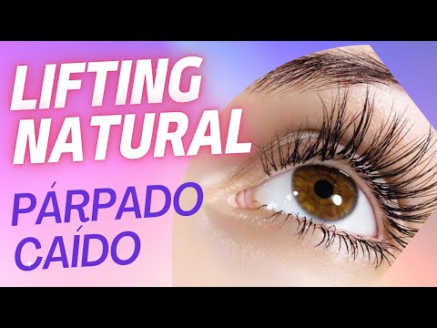 LIFTING para PÁRPADO CAÍDO y OJERAS 👀💯