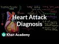 Understanding Myocardial Infarcts
