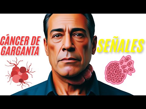 7 SEÑALES DEL CÁNCER DE GARGANTA!