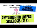 Understanding Amyotrophic Lateral Sclerosis (ALS)