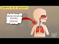 Air Pollution Causes and Effects