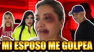 MI ESPOSO ME GOLP3Ó | NUNCA LO PERMITAN.