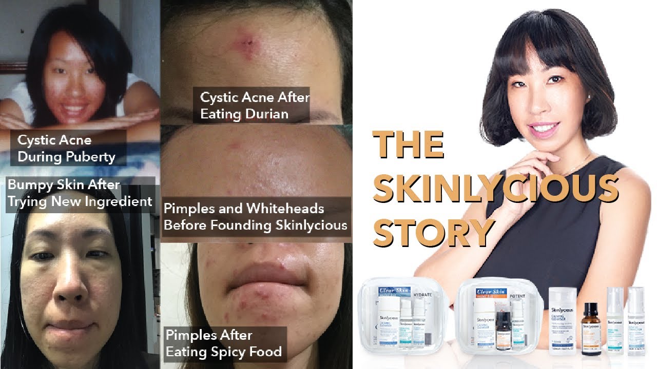 The skinlycious story
