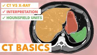 An introduction to CT scans (1/2) | A beginner's Guide