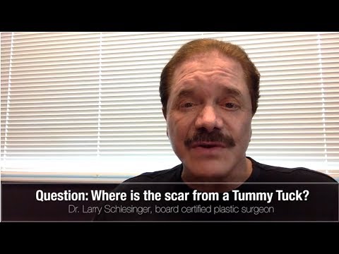 Hawaii Tummy Tuck - Where is the Scar? - Mommy Makeover Hawaii