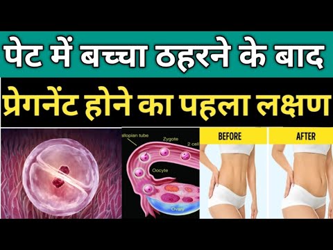 पेट में बच्चा टिकने के बाद 5 चीजें दिखने लगेगी इग्नोर मत करना. EARLY PREGNANCY SYMPTOMS.