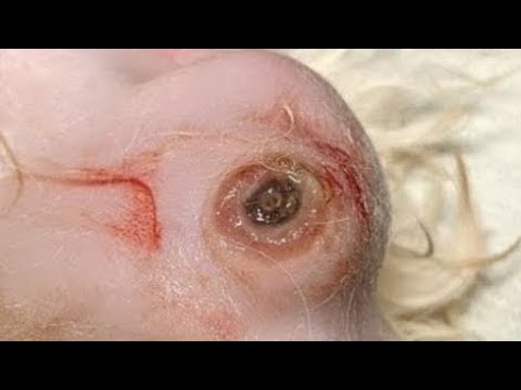 Removing A Humongous Botfly Maggot Inside Poor Dog's Back (Part 14)