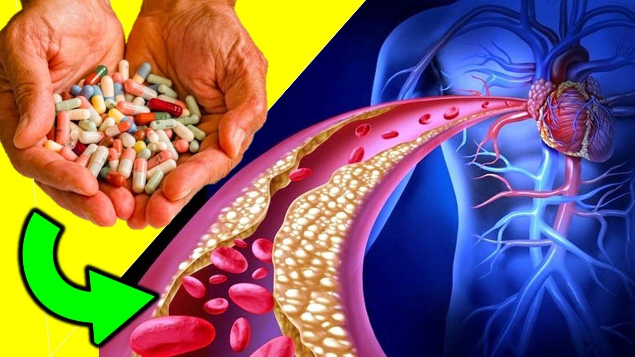 6 BEST Vitamins and Supplements to Unclog Arteries
