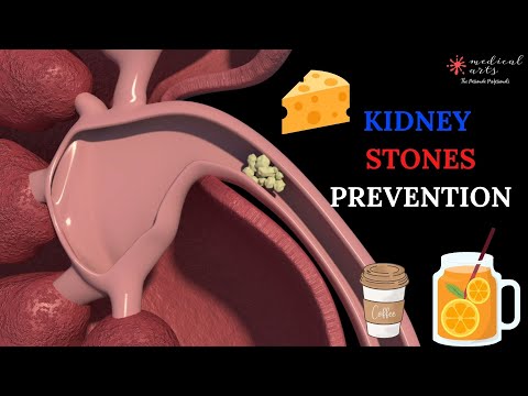 HOW TO PREVENT KIDNEY STONES - Natural remedies