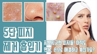 피르가즘 쩌는!! ! '클린 5단 피지 압출기'