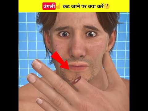 उंगली☝ कट जाने पर क्या करें🤔#shorts