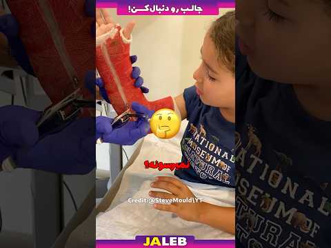 این اره اسیبی به بدن نمیرسونه!!