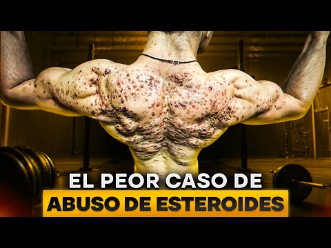 Tiene 18 años, no llegará a viejo | DOCUMENTAL