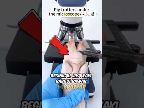 Apa itu didalam kaki 🐷😱 #shorts