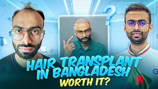 ঢাকায় হেয়ার ট্রান্সপ্লান্ট করা কি ঠিক হলো? Sabbir Ahmed