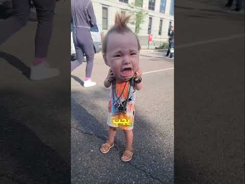 هذه الفتاه اصيبت بمرض النادر مما جعلها تموت 😭😰🤯 #اكسبلور #shortvideo #shorts #subscribe
