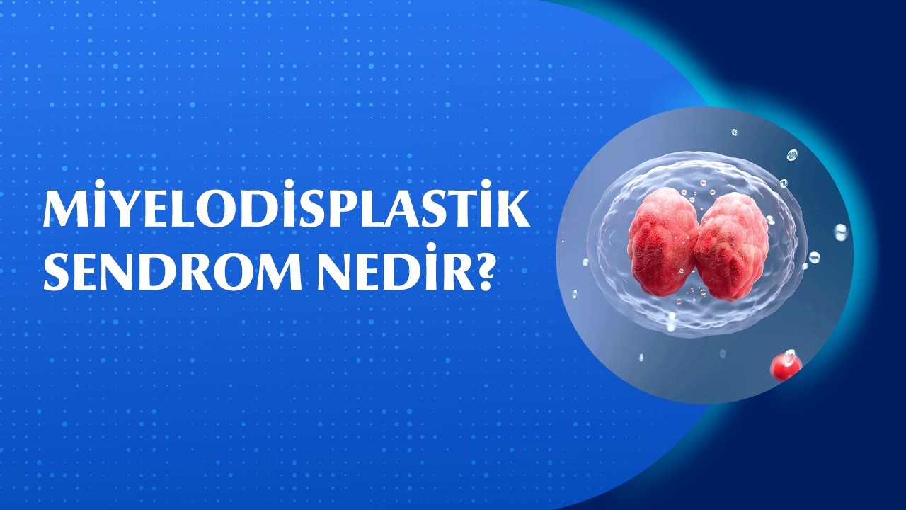 Miyelodisplastik Sendrom (MDS) Nedir? Belirtileri ve Tanı Süreci
