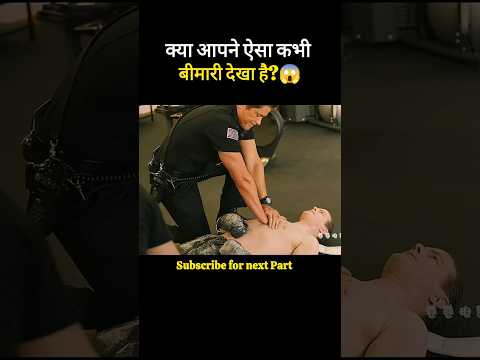 ऐसी बीमारी पहले कभी देखी है? 😱 #shorts  #trending