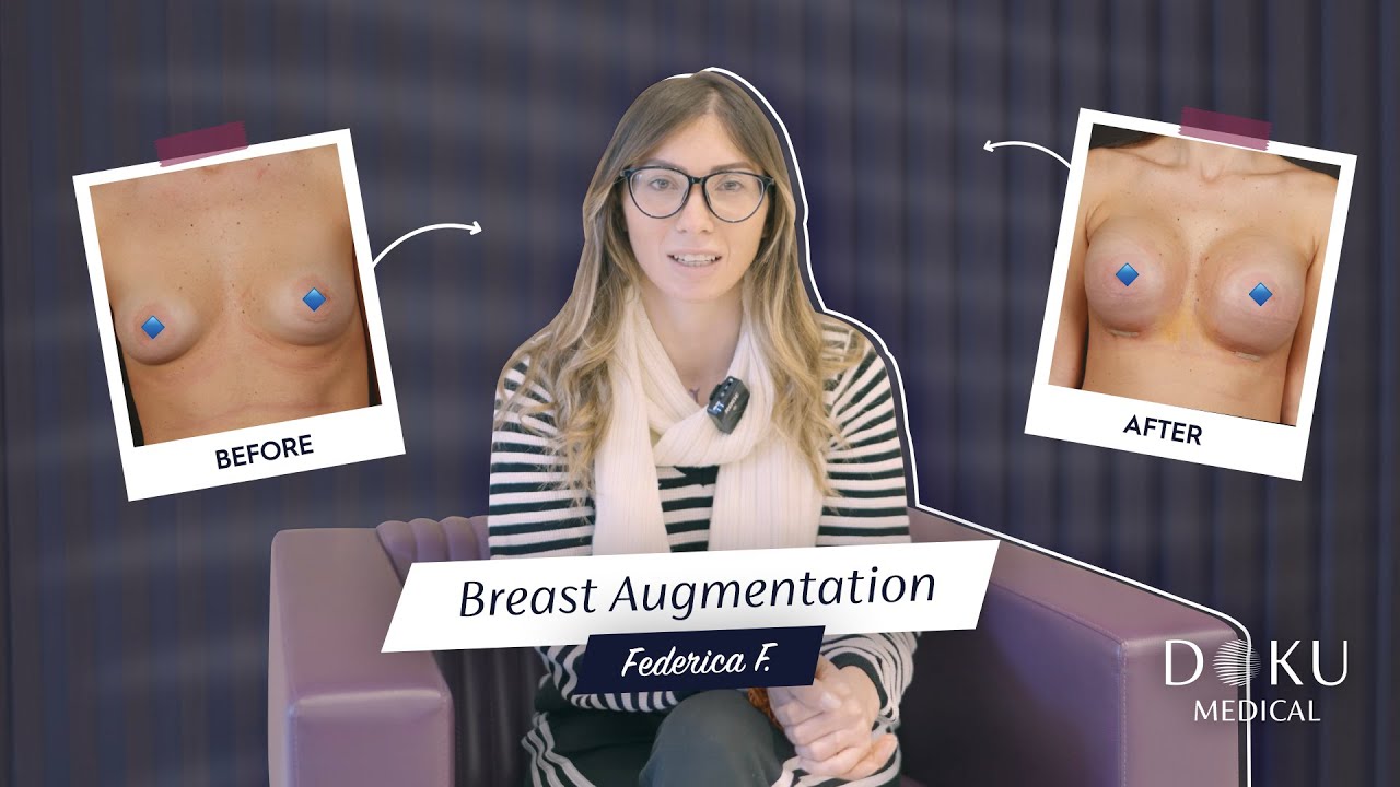 Breast augmentation operation #Documedical