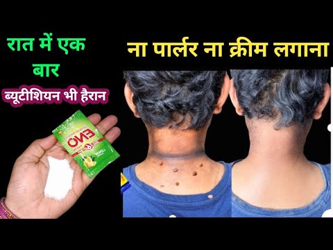 5 मिनट में काली गर्दन को गोरा करने का सबसे अच्छा उपाय II Whiten Skin Treatment