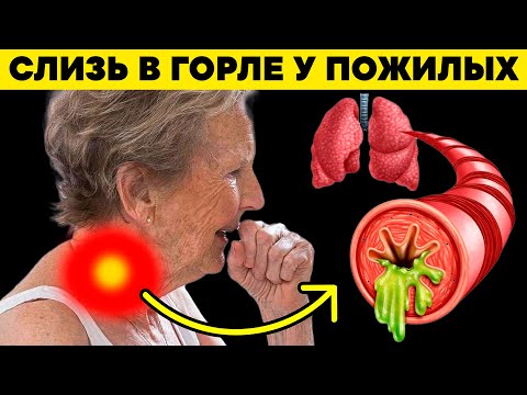 Почему пожилые откашливают СЛИЗЬ каждый день? Как остановить утренний кашель и мокроту
