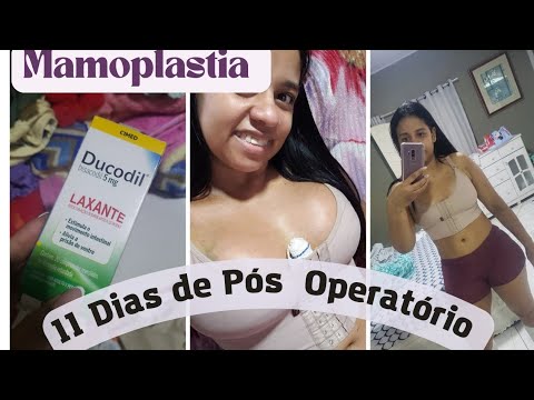 PÓS OPERATÓRIO/ CONSULTA +ULTRASSOM