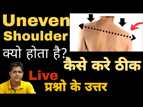 एक साइड का कंधा उपर और एक साइड का नीचे कैसे ठीक करे। Uneven Shoulder Treatment. #unevenshoulder