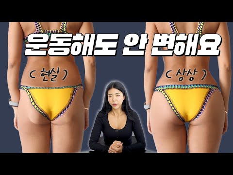 이런 엉덩이 모양은 운동으로 바꾸기 어려워요. (뒷 허벅지가 자꾸 아픈 이유)